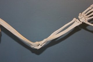 Strong Bones Arm