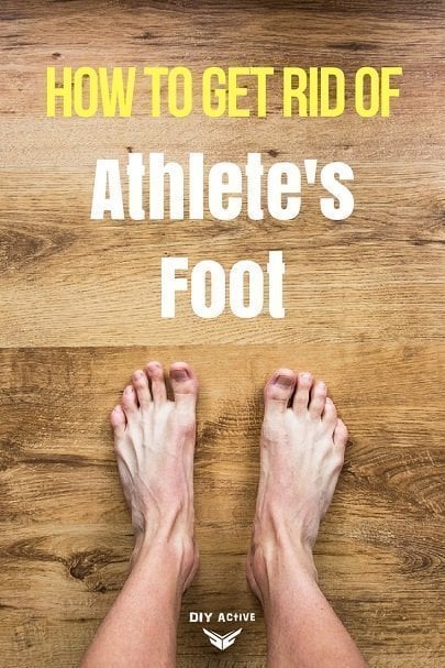 How to Get Rid of Athlete's Foot