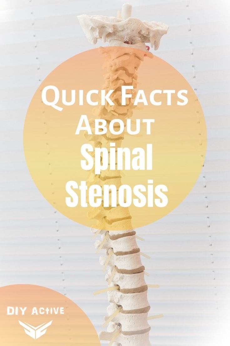 Spinal Stenosis: What is It, Symptoms, and Treatment