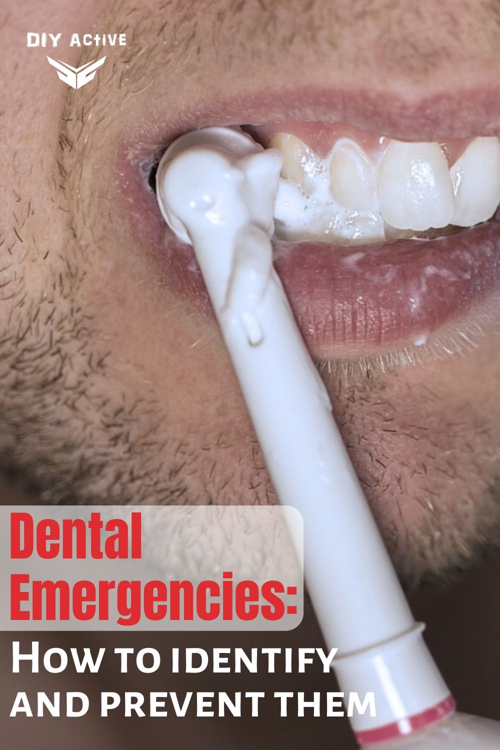 Dental Emergencies How to identify prevent them