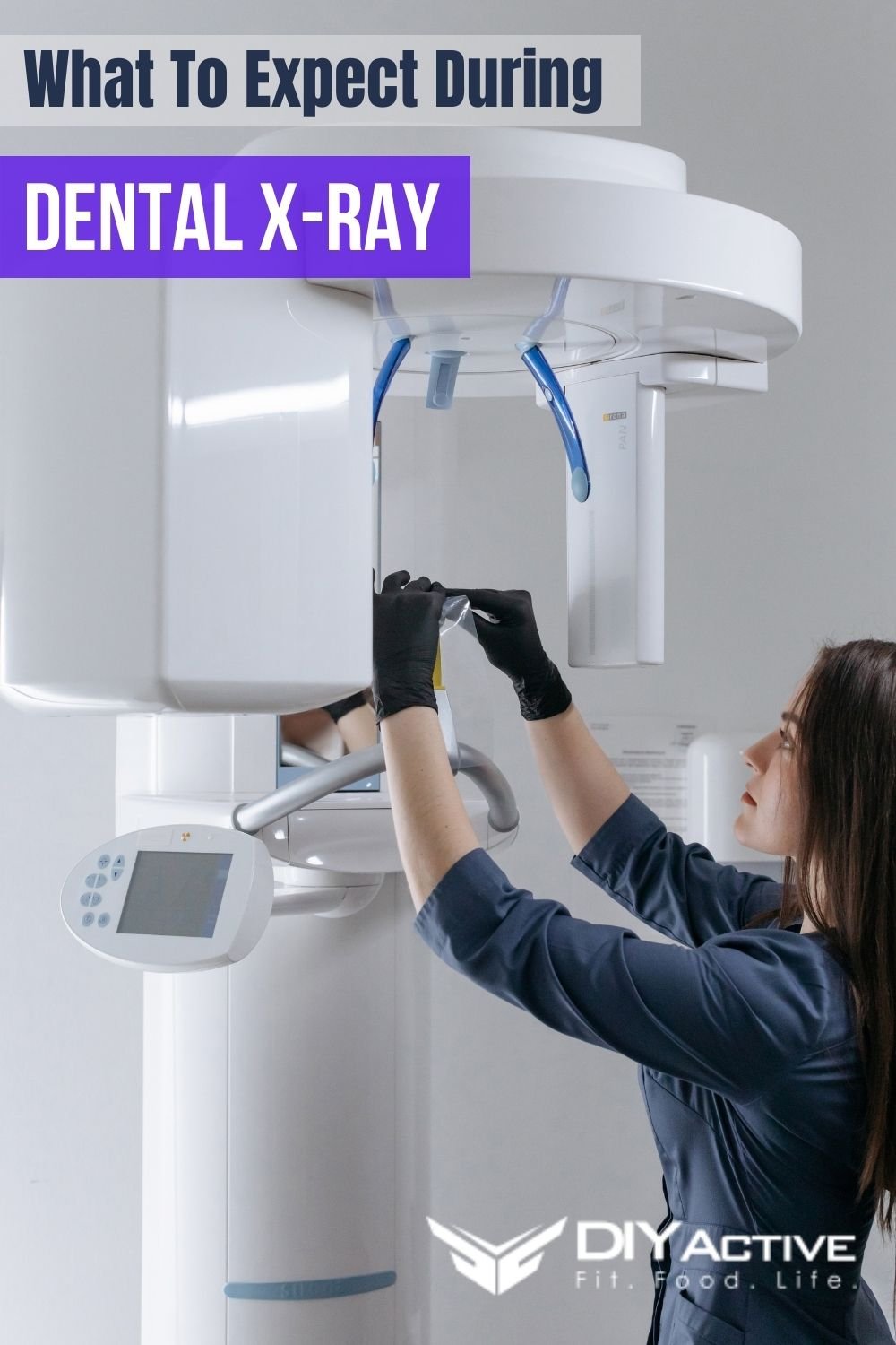 What To Expect During A Dental X-Ray 2