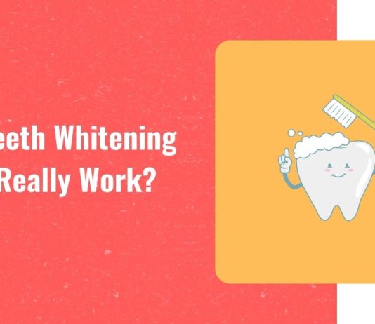 Do teeth whitening kits really work