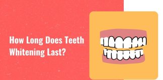 How long does teeth whitening last