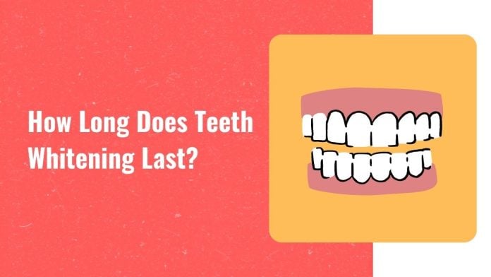 How long does teeth whitening last