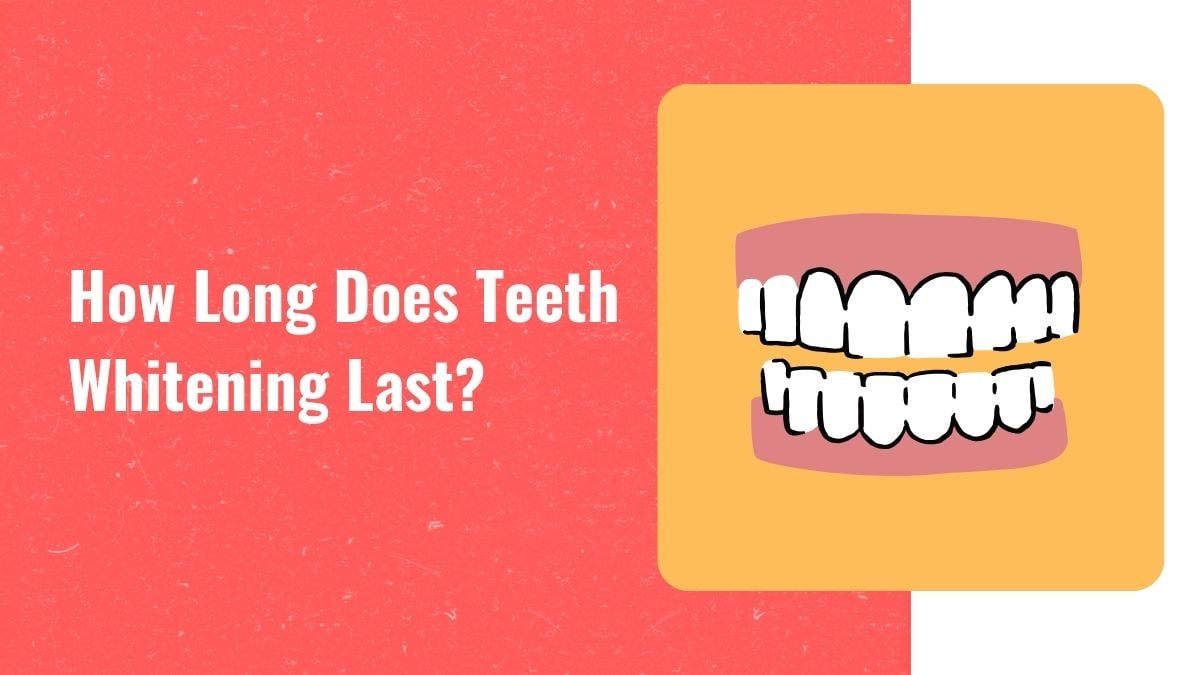How Long Does Teeth Whitening Last? DIY Active