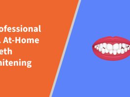 Professional vs. At-Home Teeth Whitening