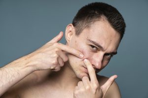 How To Get Clear Skin For Men
